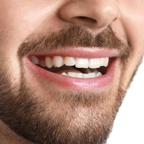 Harmonie sonrrisa Hombre