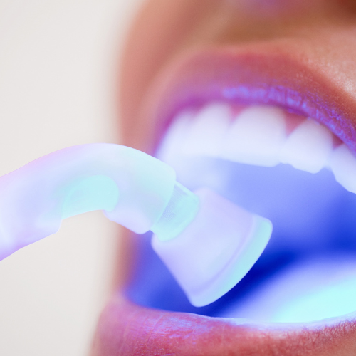 Tratamientos laser harmonie